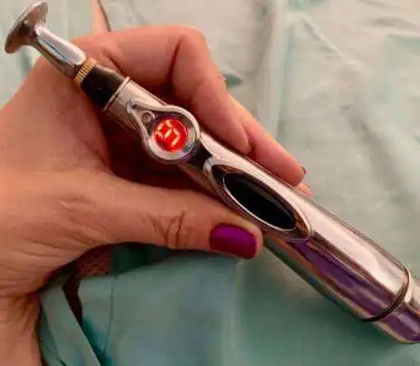 Electric Acupuncture Pen to Heal Body Pain on Your Own - 312039298 312039298