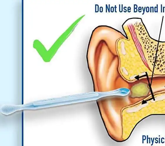 Earwax Cleaner That's More Effective Than Swab - 91at rdTFbL. AC SL1500 91at rdTFbL. AC SL1500
